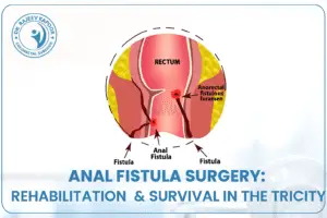 Anal Fistula Surgery in Chandigarh