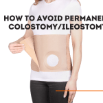 how to avoid permanent colostomy