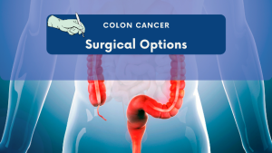 Surgery for colon cancer