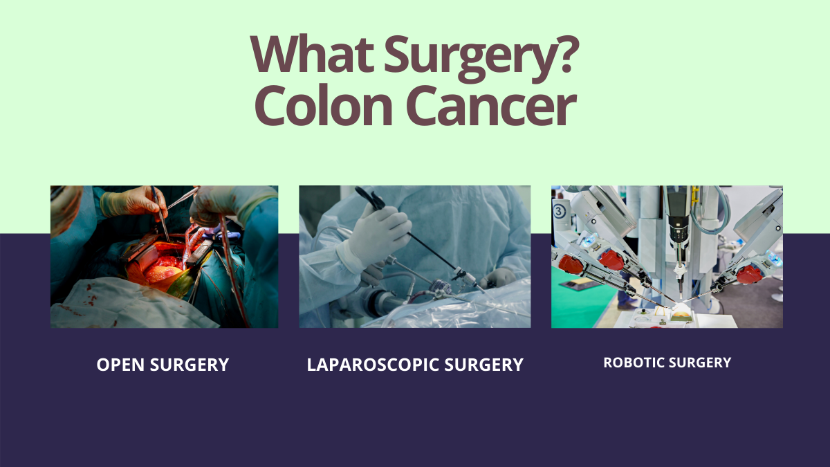 Surgery for colon cancer