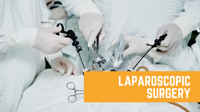 Laparoscopic/key hole surgery