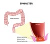 sphincter preservation surgery for Rectal Cancer