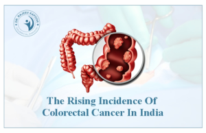 Colorectal Cancer In India