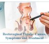 Rectovaginal Fistula: Causes, Symptoms, And Treatment