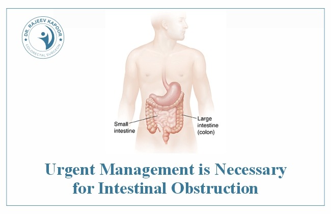 Urgent Management Is Necessary For Intestinal Obstruction