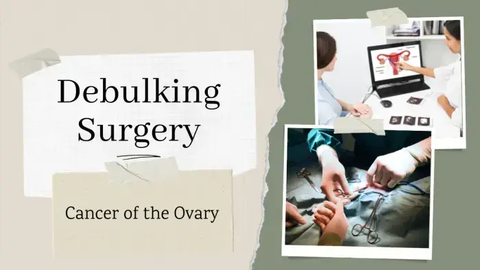 ovarian-cancer-details-of-diagnosis-investigations-and-treatment