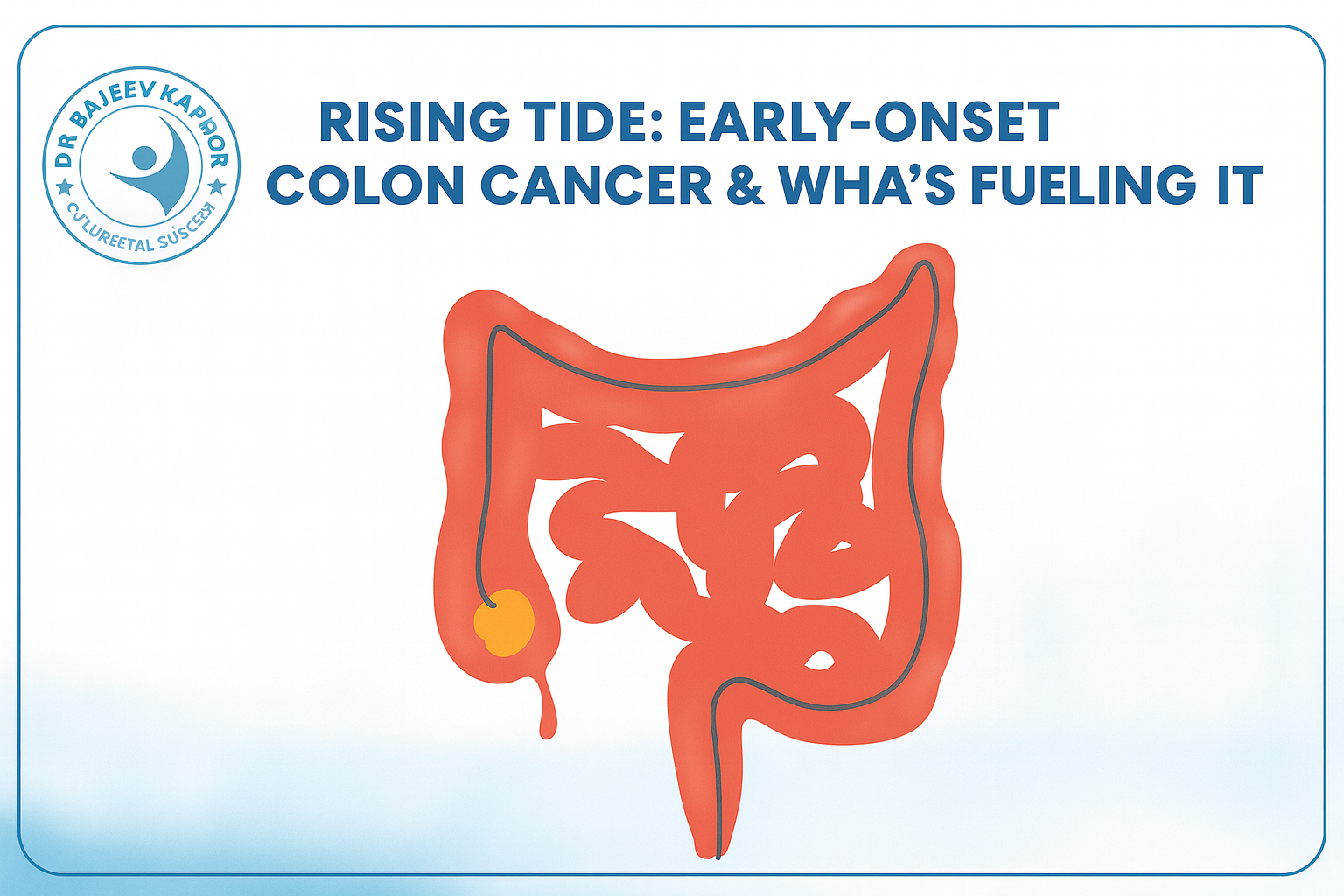 Rising Tide: Early-Onset Colon Cancer & What’s Fueling It