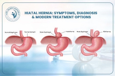 Hiatal Hernia Treatment in Chandigarh