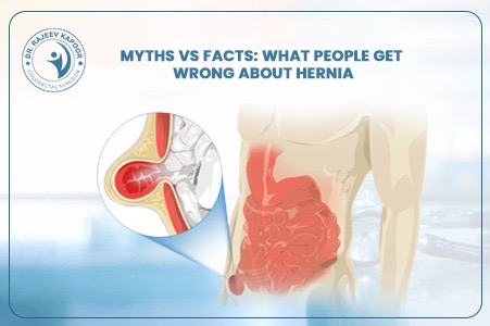 myth and fact about Hernia
