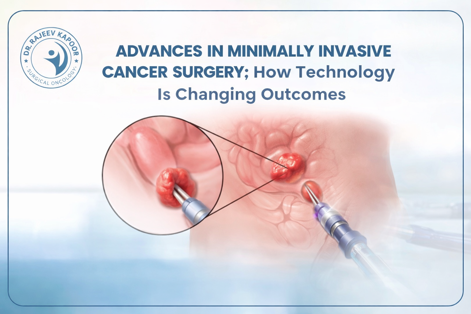 Advances in Minimally Invasive Cancer Surgery: How Technology Is Changing Outcomes