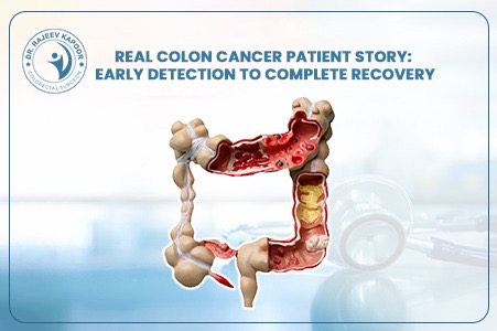 Colon Cancer Patient Story