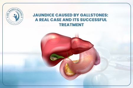 Jaundice Caused by Gallstones: A Real Case and Its Successful Treatment