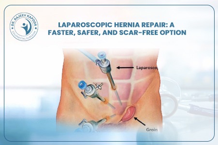 Laparoscopic Hernia Repair