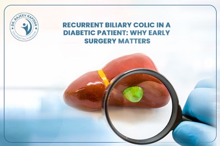 Recurrent Biliary Colic