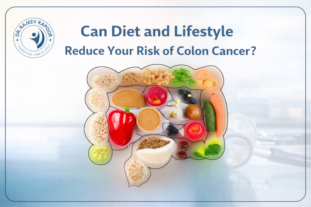 diet to reduce your risk of colon cancer