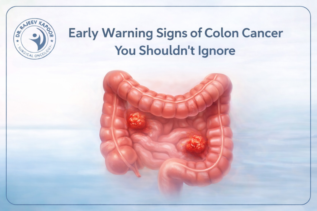 Early Sign of Colon Cancer