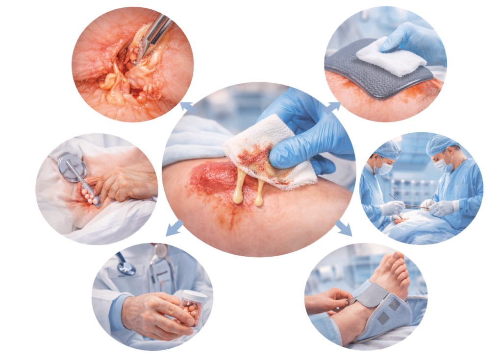 Complex Wounds Treatment in Mohali