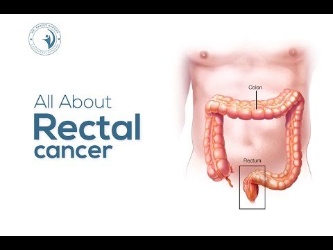 All About Rectal Cancer — Dr. Rajeev Kapoor
