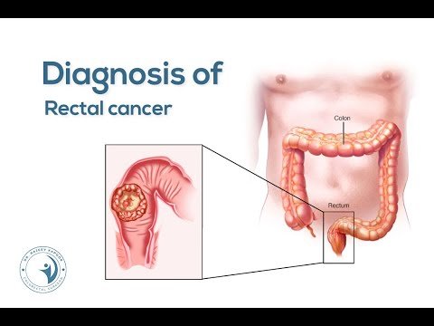 Diagnosis of Rectal Cancer — Dr. Rajeev Kapoor