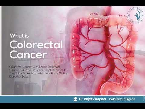What is Colorectal Cancer — Dr. Rajeev Kapoor