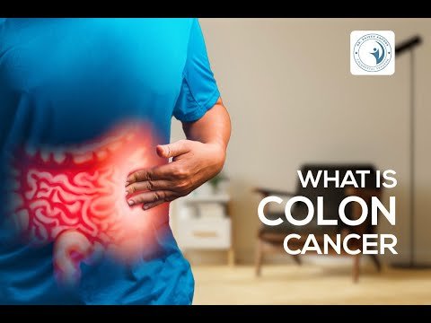 All About Colon Cancer — Dr. Rajeev Kapoor