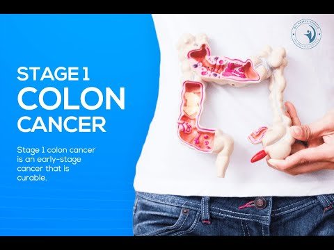 Stage 1 Colon Cancer is Curable — Dr. Rajeev Kapoor