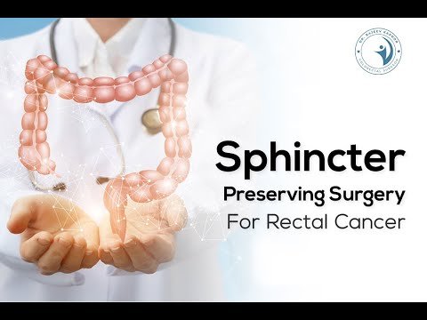 Sphincter Preserving Surgery for Rectal Cancer — Dr. Rajeev Kapoor