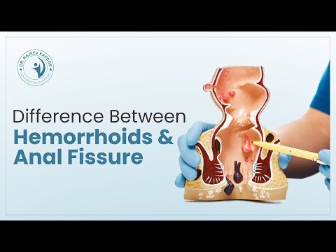 Piles, Hemorrhoids and Anal Fissure — Dr. Rajeev Kapoor, Chandigarh