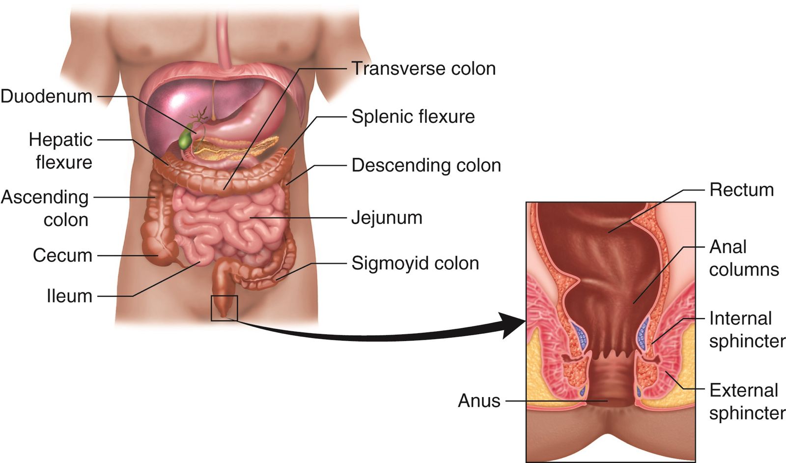 Colorectal Cancer