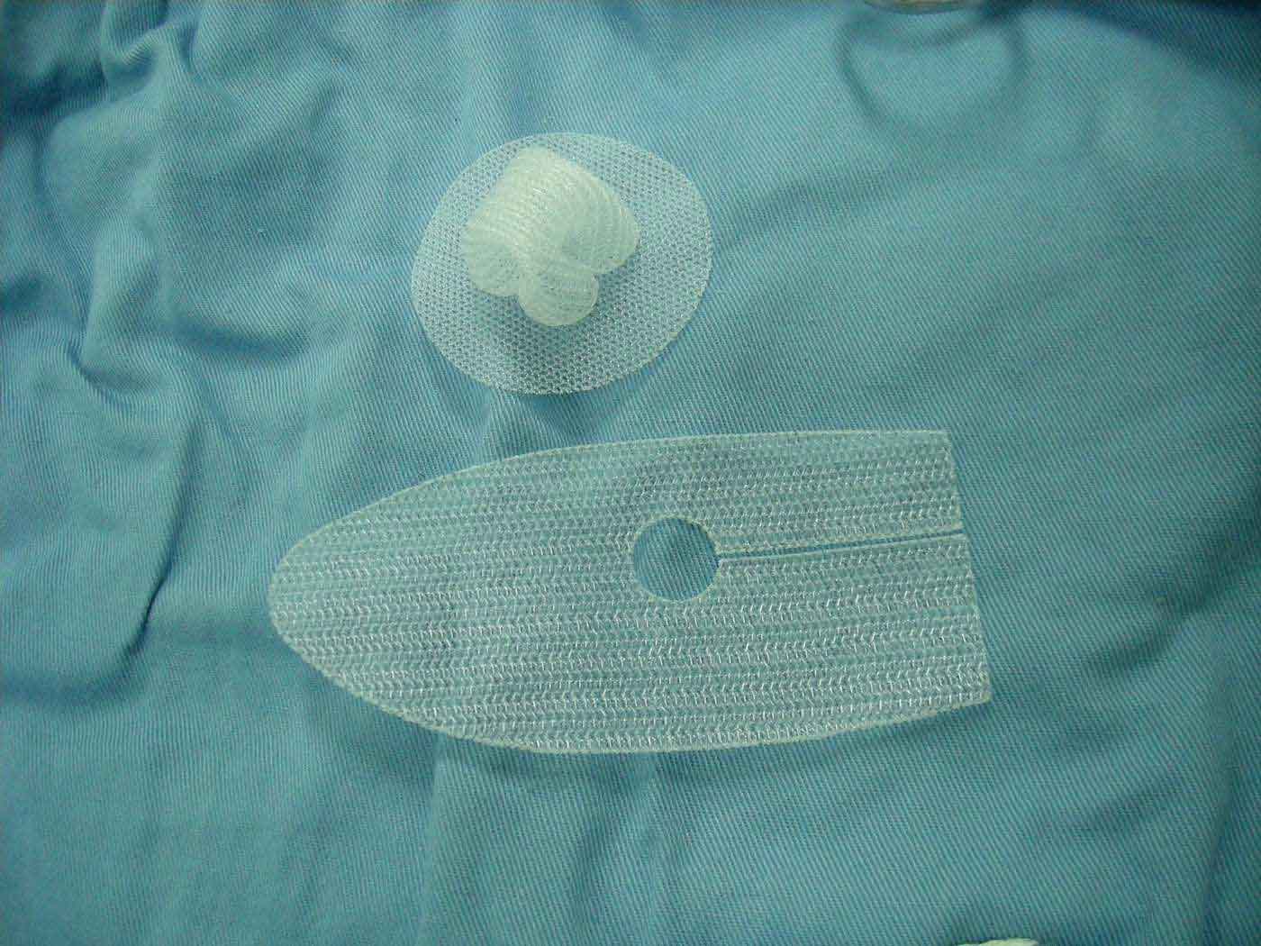 Synthetic mesh used in inguinal hernia repair to reinforce the abdominal wall
