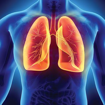 Low-dose CT scan used for lung cancer screening