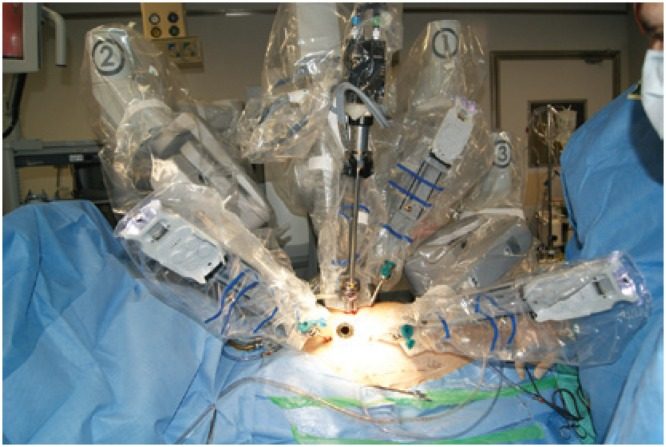 colon robotic