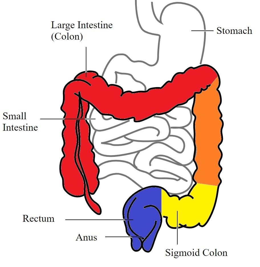 colonoscopy expect