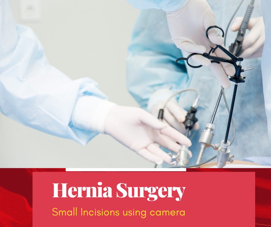 hernia