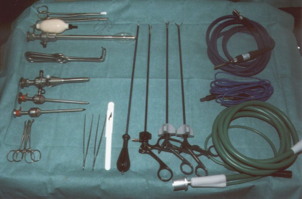 incisional hernia