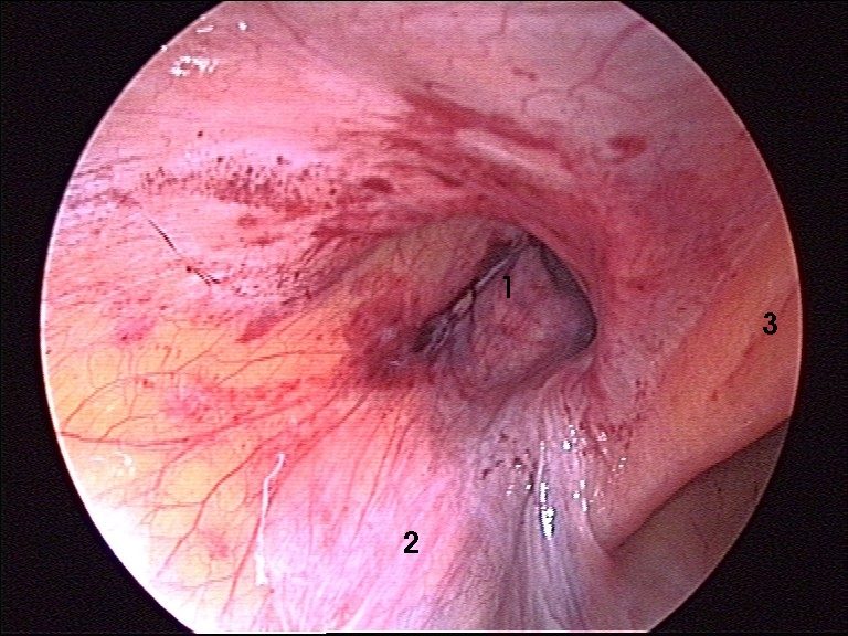 inguinal anatomy