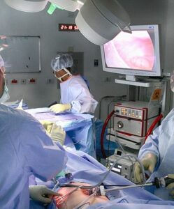 obturator hernia